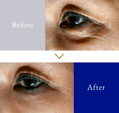 目周り 50代 女性